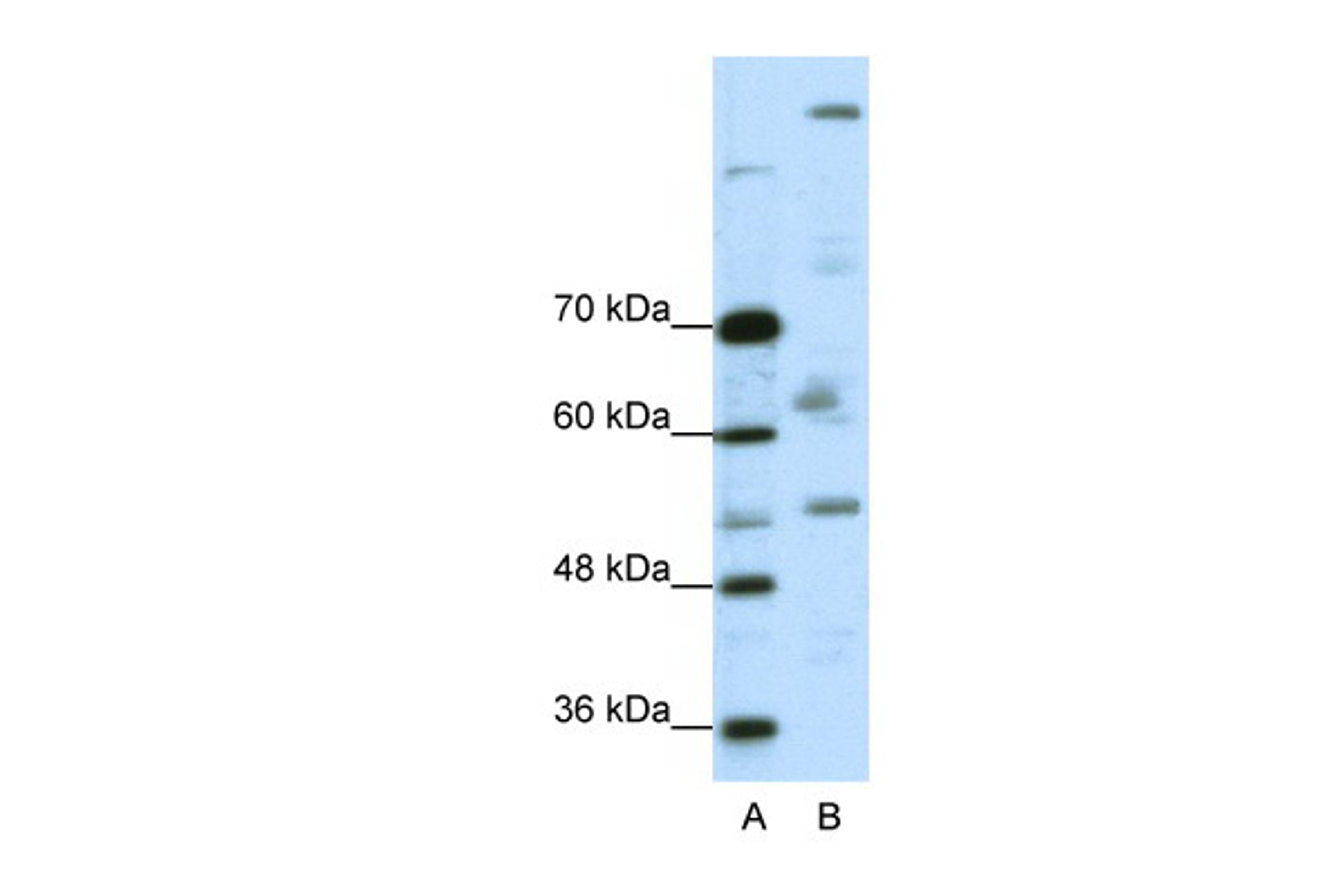 Antibody used in WB on Human A204 cells at 0.2-1 ug/ml.