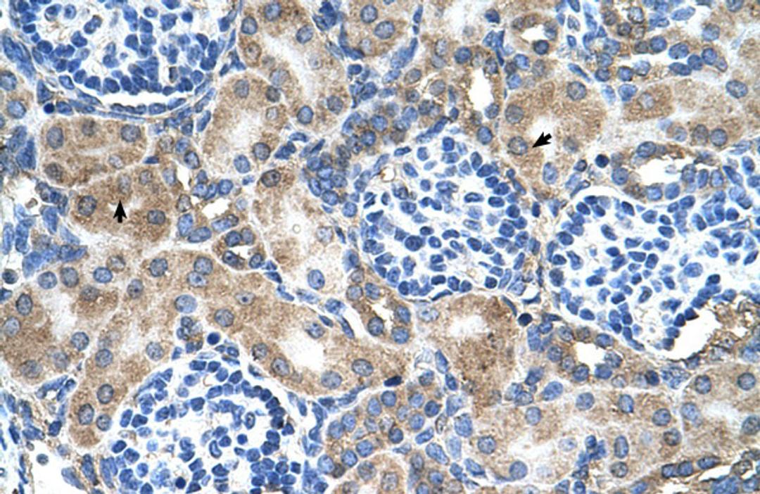 Antibody used in IHC on Human kidney.