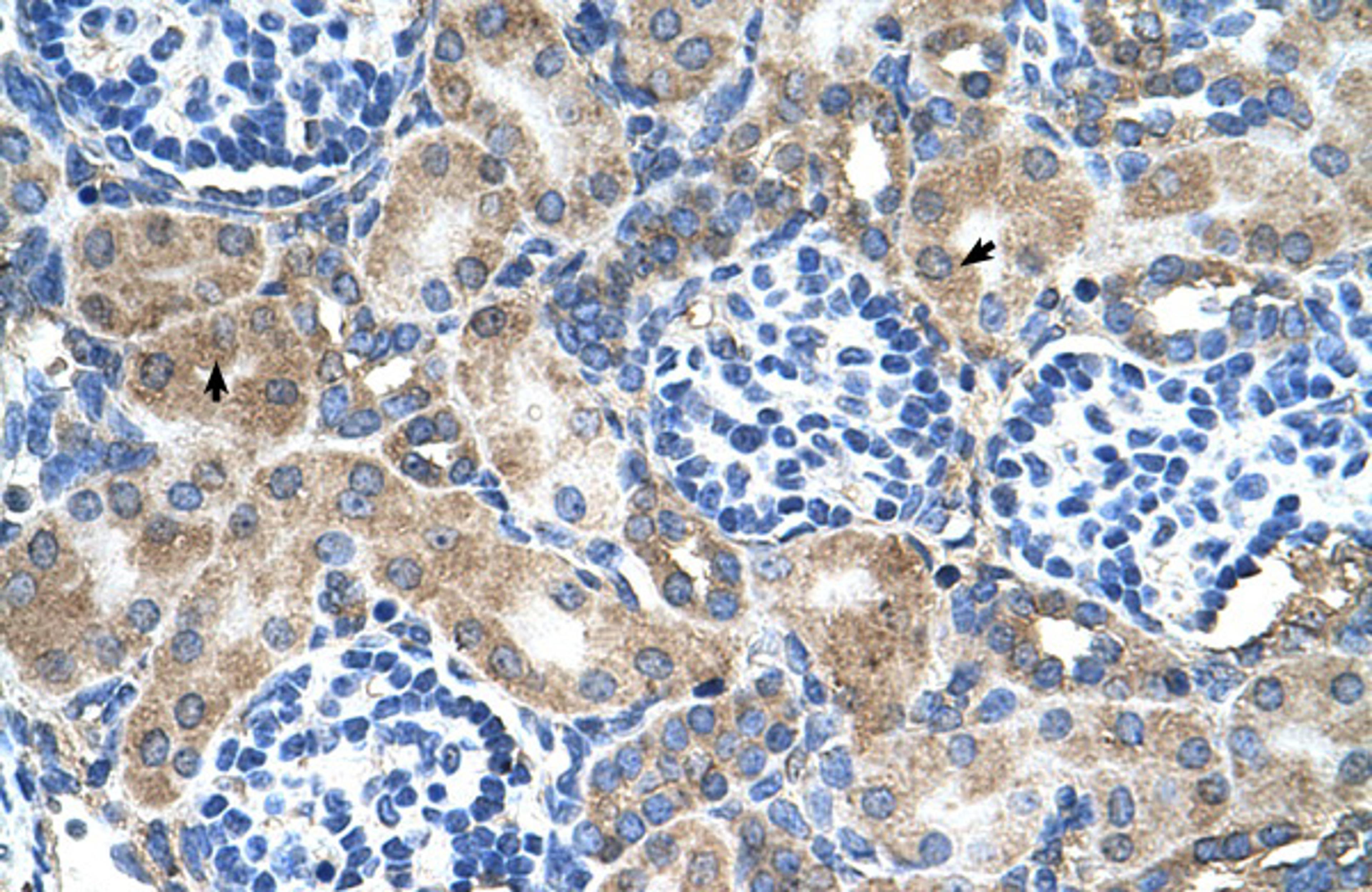 Antibody used in IHC on Human kidney.