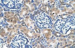 Antibody used in IHC on Human kidney.