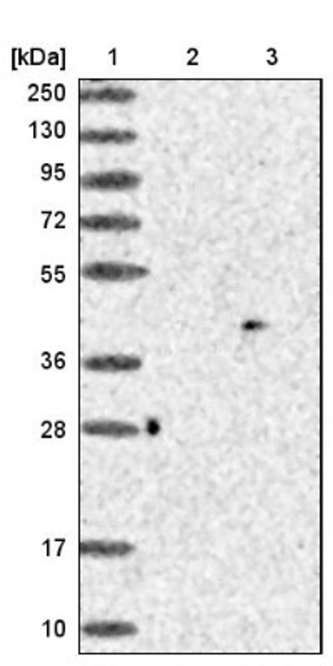 Western Blot: PARP11 Antibody [NBP1-88394] - Lane 1: Marker [kDa] 250, 130, 95, 72, 55, 36, 28, 17, 10<br/>Lane 2: Negative control (vector only transfected HEK293T lysate)<br/>Lane 3: Over-expression lysate (Co-expressed with a C-terminal myc-DDK tag (~3.1 kDa) in mammalian HEK293T cells, LY402774)