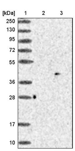 Western Blot: PARP11 Antibody [NBP1-88394] - Lane 1: Marker [kDa] 250, 130, 95, 72, 55, 36, 28, 17, 10<br/>Lane 2: Negative control (vector only transfected HEK293T lysate)<br/>Lane 3: Over-expression lysate (Co-expressed with a C-terminal myc-DDK tag (~3.1 kDa) in mammalian HEK293T cells, LY402774)