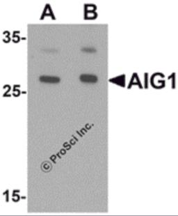 Western blot analysis of AIG1 in human brain tissue lysate with AIG1 antibody at (A) 1 and (B) 2 &#956;g/mL.