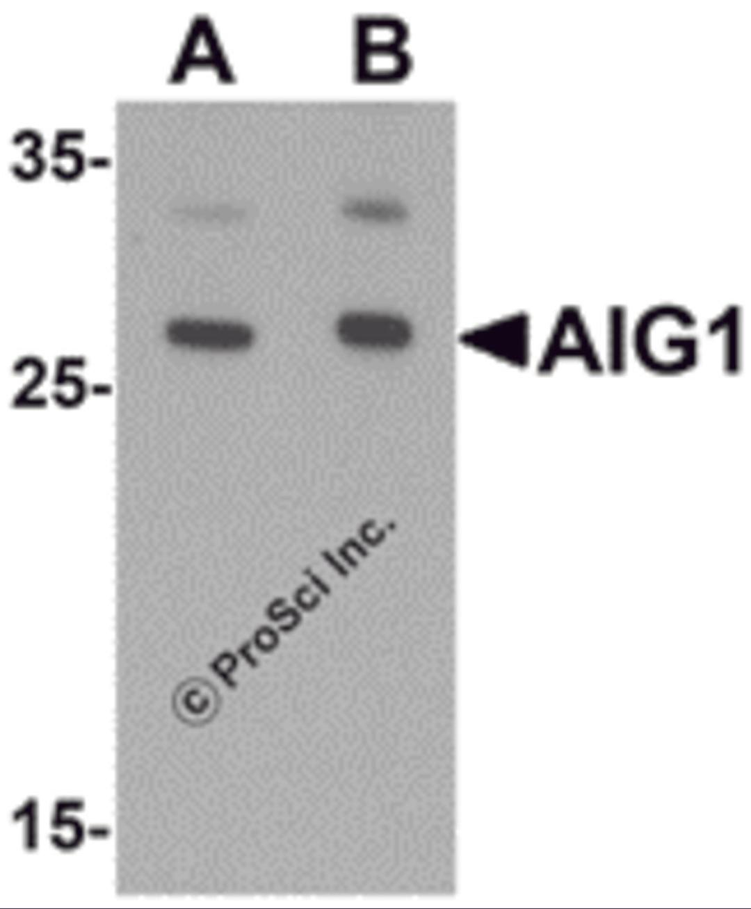 Western blot analysis of AIG1 in human brain tissue lysate with AIG1 antibody at (A) 1 and (B) 2 μg/mL.