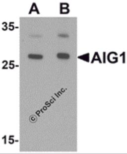 Western blot analysis of AIG1 in human brain tissue lysate with AIG1 antibody at (A) 1 and (B) 2 μg/mL.