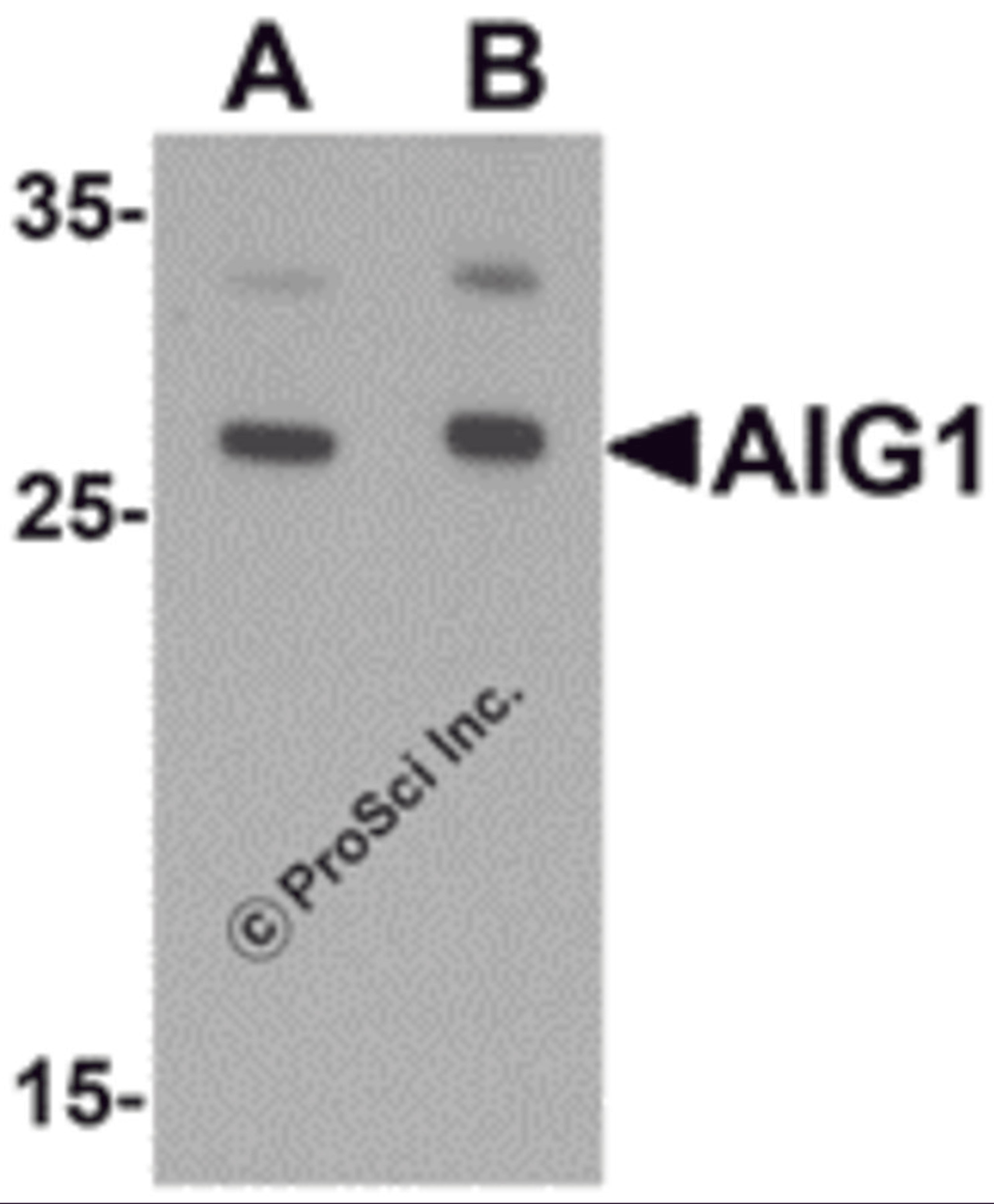Western blot analysis of AIG1 in human brain tissue lysate with AIG1 antibody at (A) 1 and (B) 2 μg/mL.