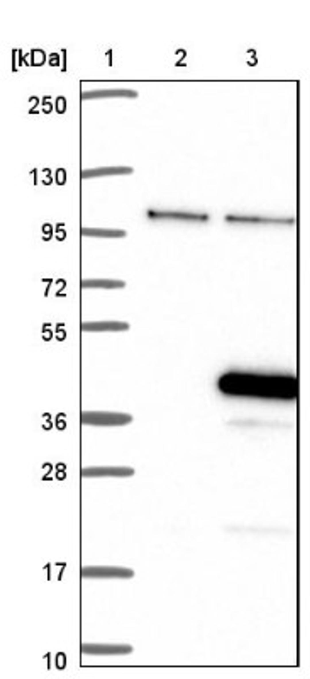 Western Blot: SFRS7 Antibody [NBP1-92382] - Lane 1: Marker [kDa] 250, 130, 95, 72, 55, 36, 28, 17, 10<br/>Lane 2: Negative control (vector only transfected HEK293T lysate)<br/>Lane 3: Over-expression lysate (Co-expressed with a C-terminal myc-DDK tag (~3.1 kDa) in mammalian HEK293T cells, LY421899)