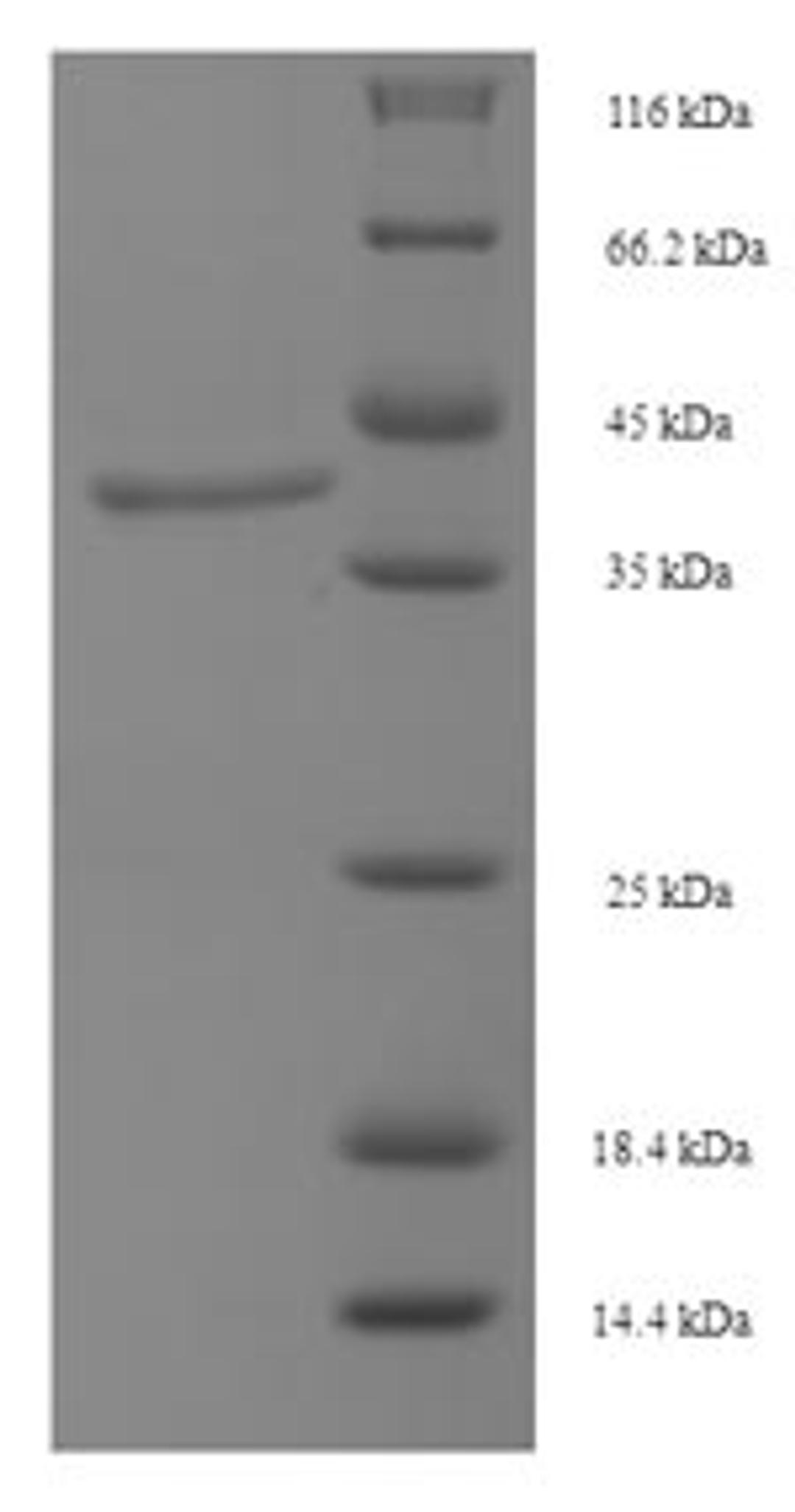 (Tris-Glycine gel) Discontinuous SDS-PAGE (reduced) with 5% enrichment gel and 15% separation gel.