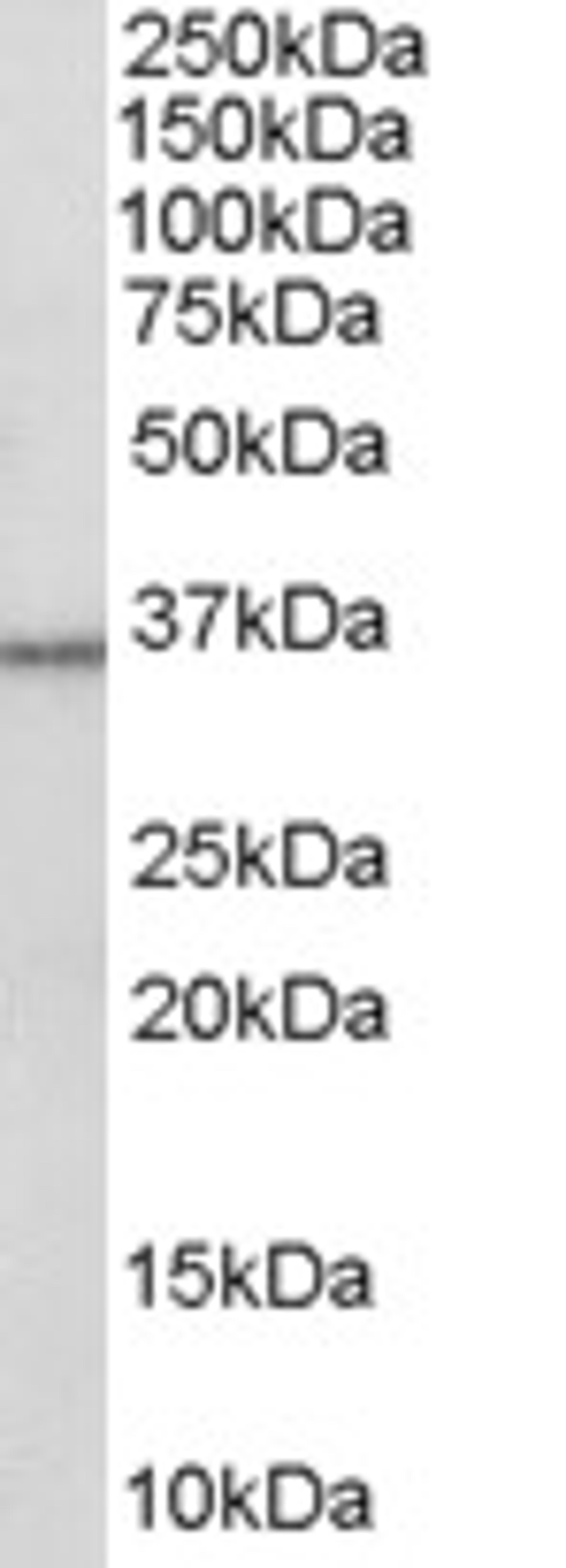 45-748 (0.3ug/ml) staining of Human Liver lysate (35ug protein in RIPA buffer). Primary incubation was 1 hour. Detected by chemiluminescence.