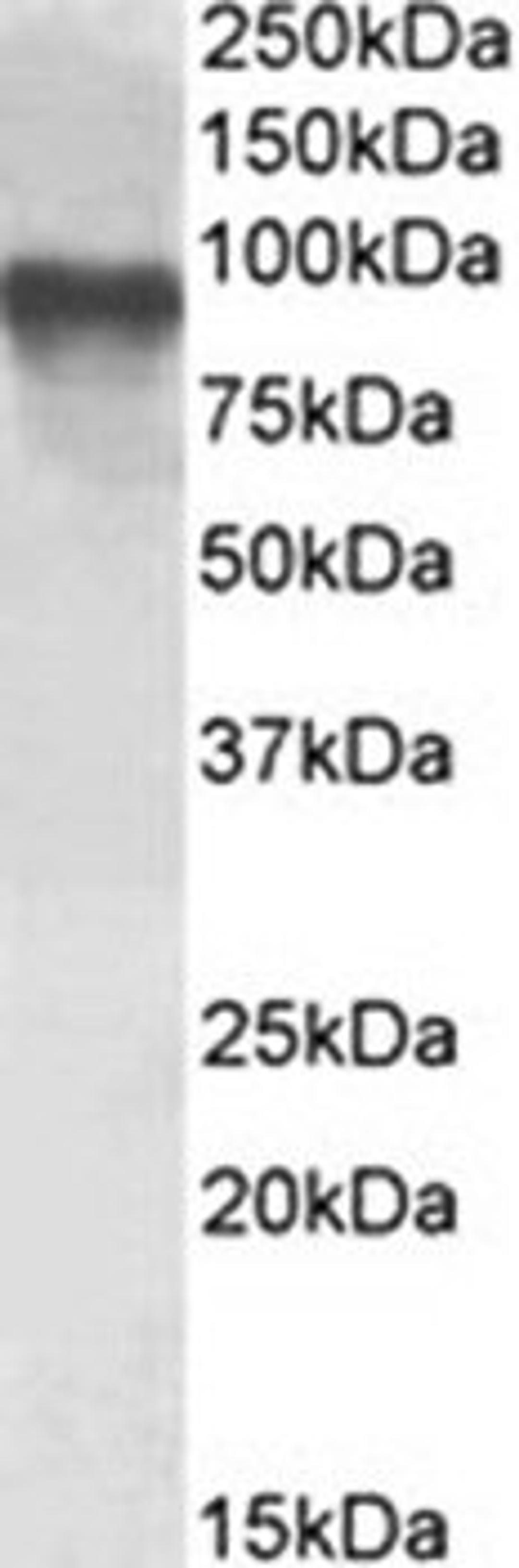 Western blot analysis of Jurkat cell lysate using mTORC2 antibody