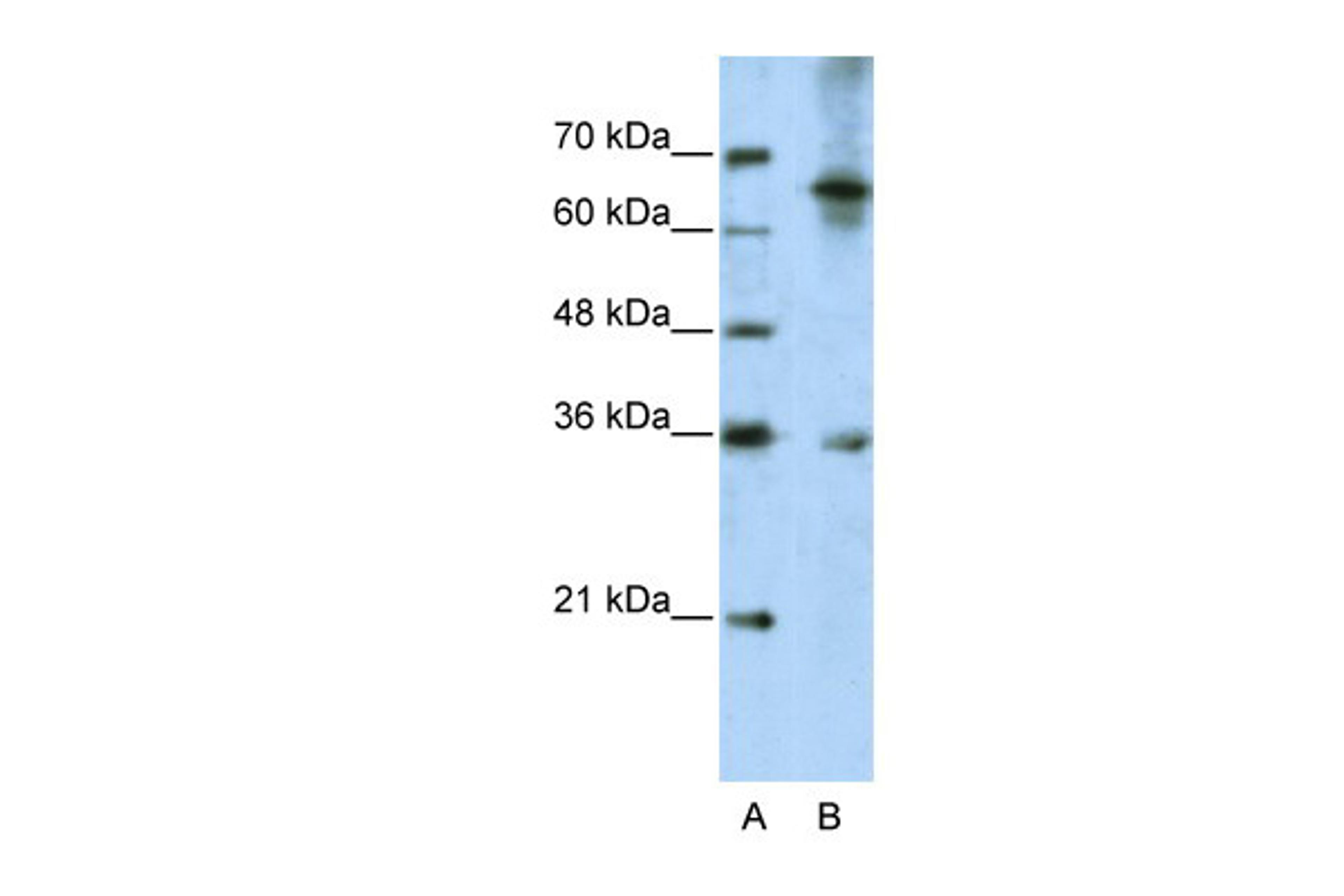 Antibody used in WB on Human Jurkat 5.0 ug/ml.