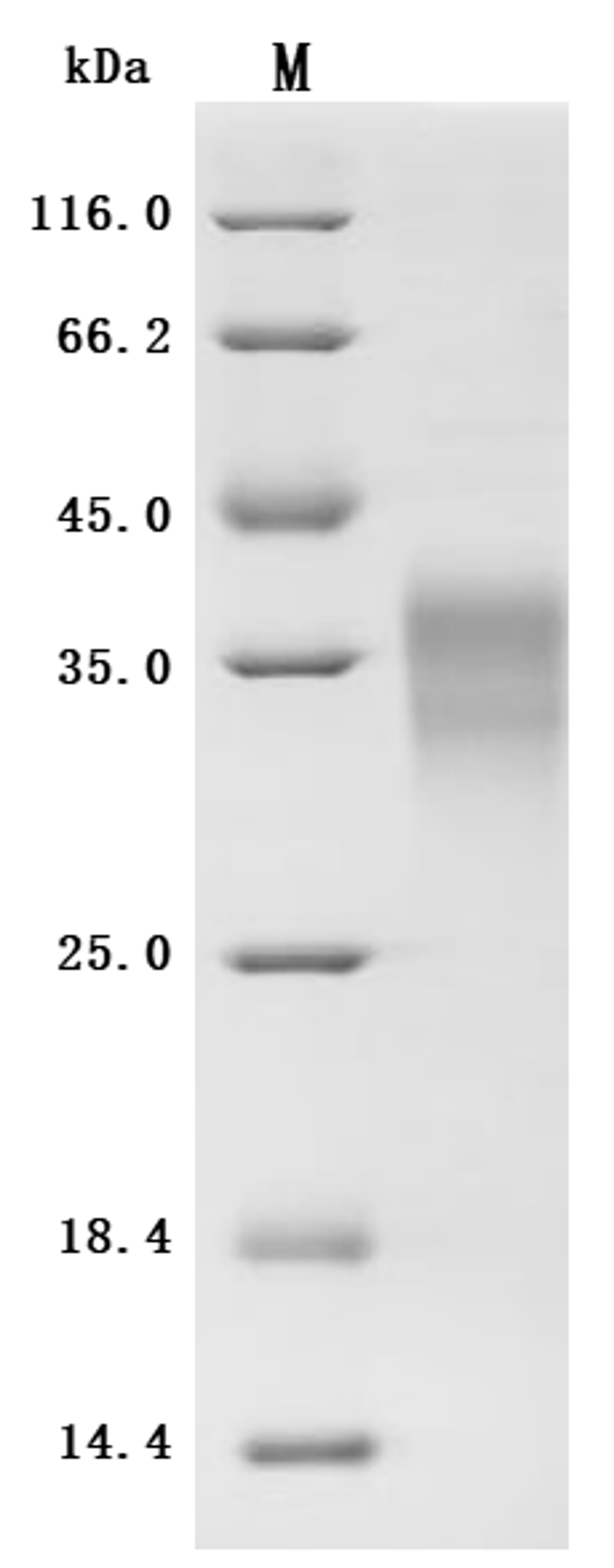 (Tris-Glycine gel) Discontinuous SDS-PAGE (reduced) with 5% enrichment gel and 15% separation gel.