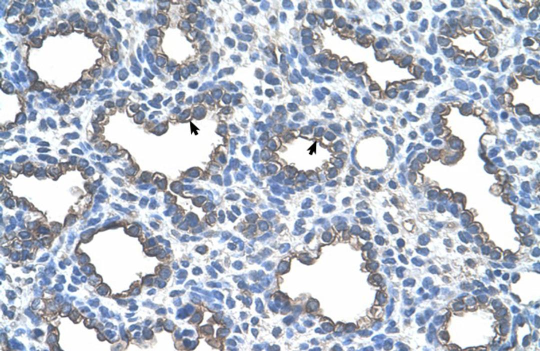 Antibody used in IHC on Human Lung.