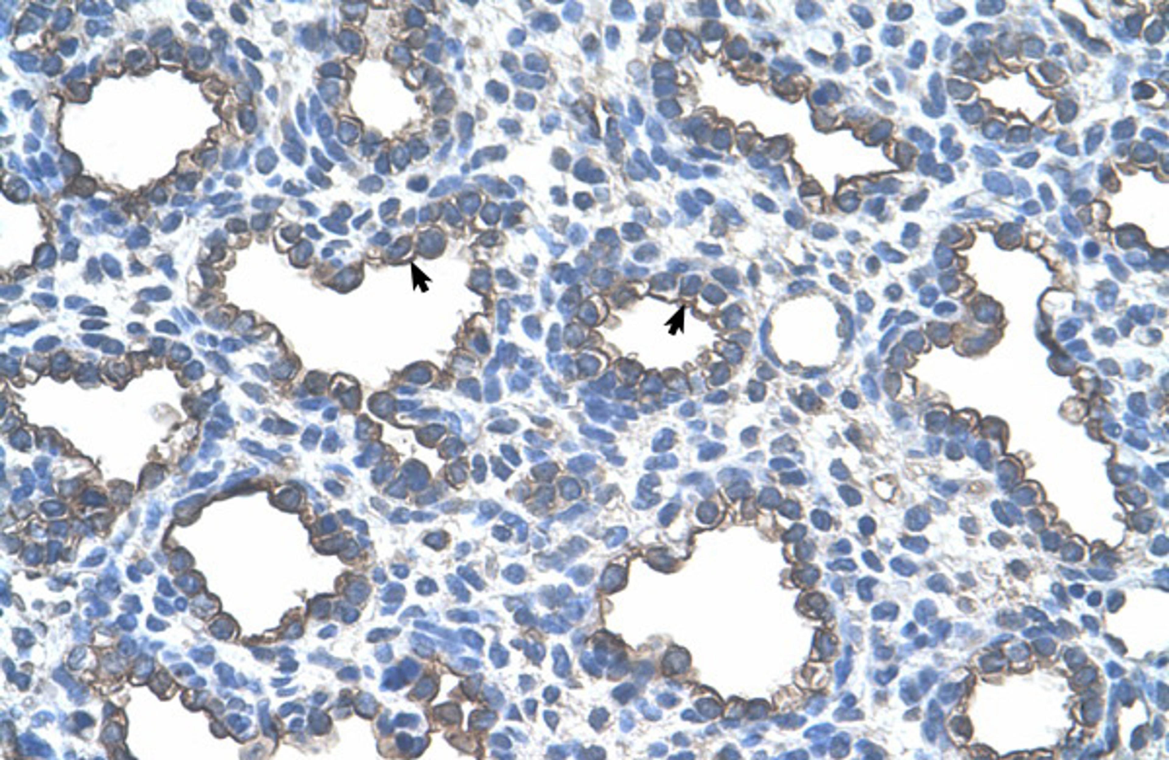 Antibody used in IHC on Human Lung.