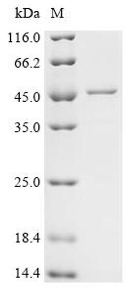 (Tris-Glycine gel) Discontinuous SDS-PAGE (reduced) with 5% enrichment gel and 15% separation gel.
