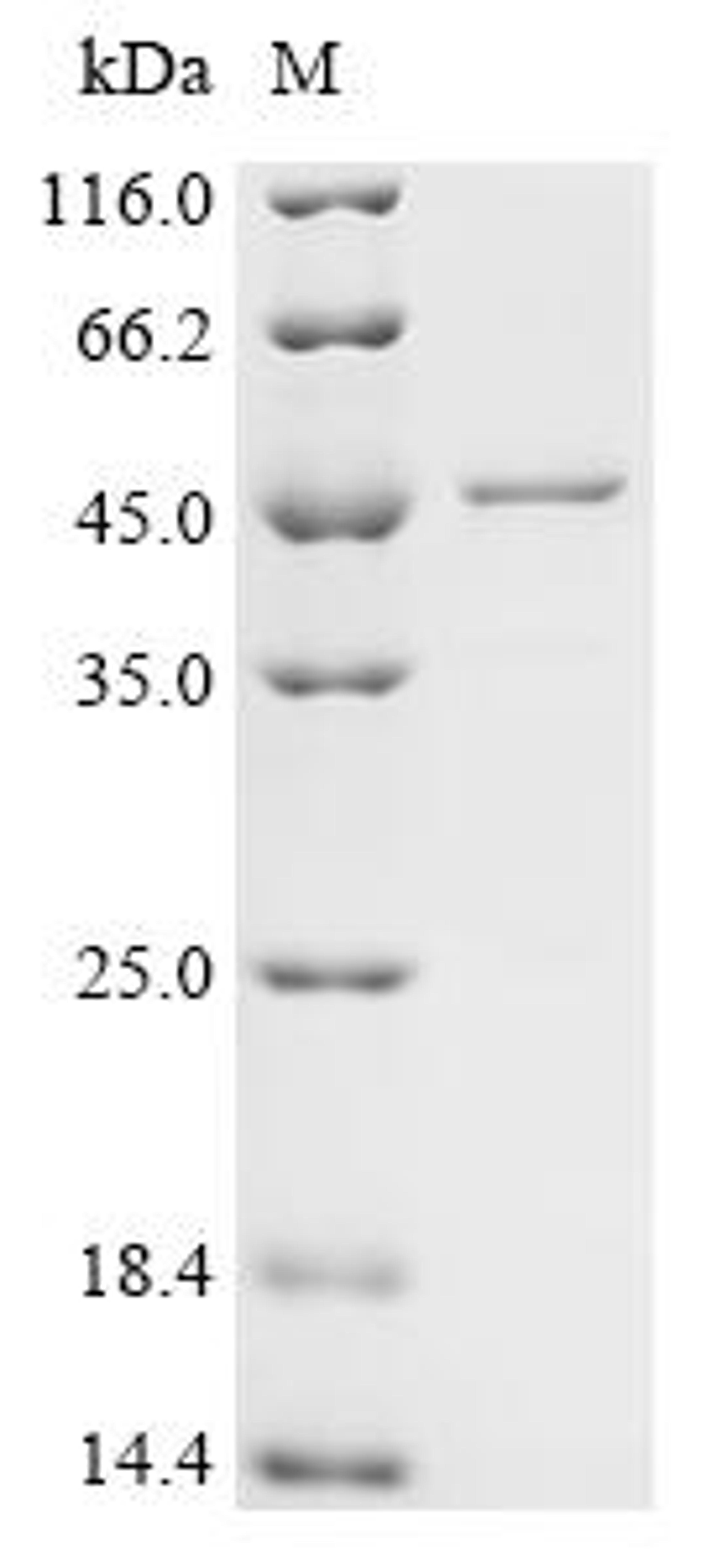(Tris-Glycine gel) Discontinuous SDS-PAGE (reduced) with 5% enrichment gel and 15% separation gel.