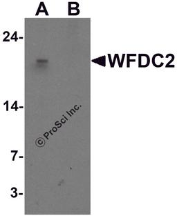 Western blot analysis of WFDC2 in A549 cell lysate with WFDC2 antibody at 1 μg/ml in (A) the absence and (B) the presence of blocking peptide.