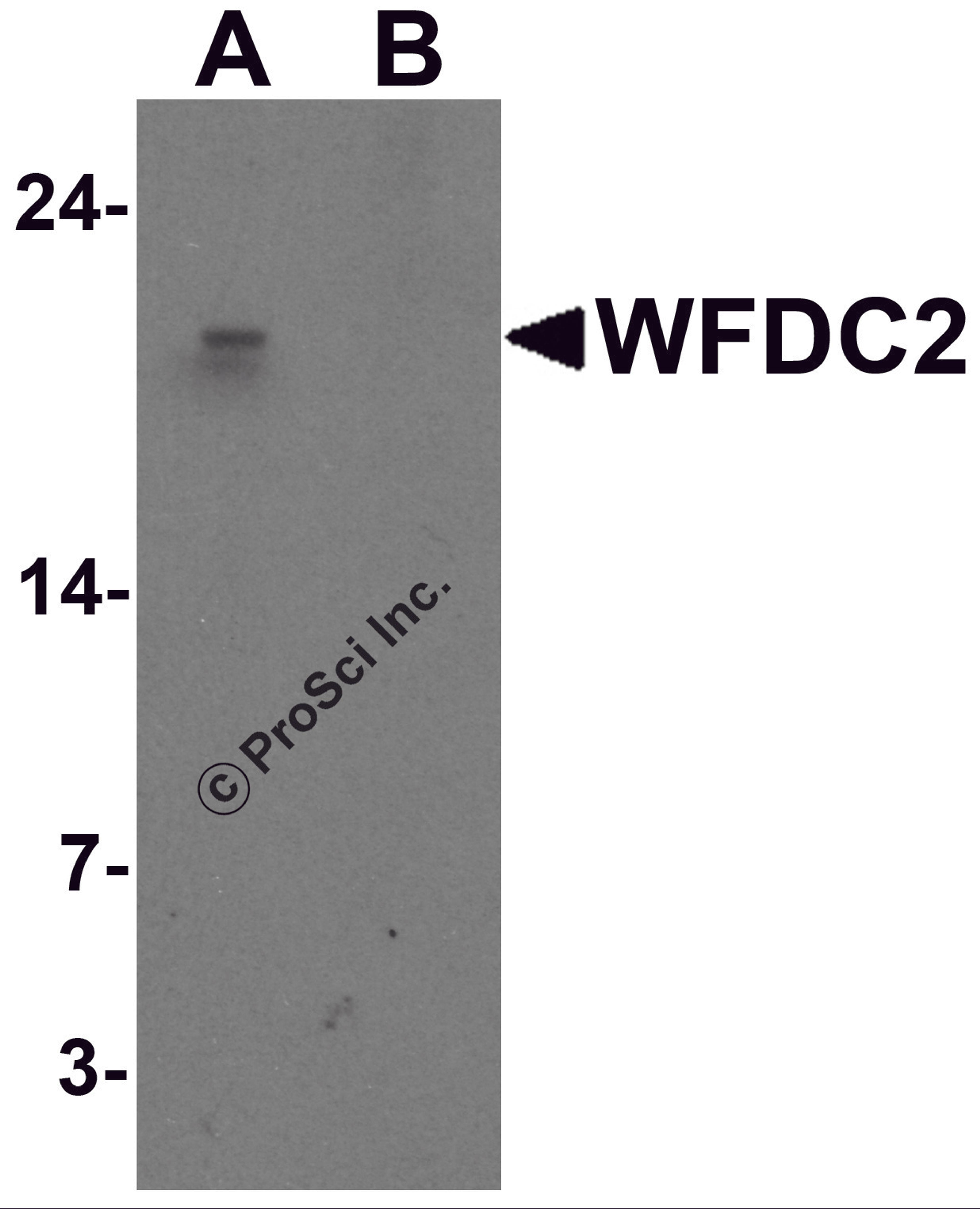 Western blot analysis of WFDC2 in A549 cell lysate with WFDC2 antibody at 1 μg/ml in (A) the absence and (B) the presence of blocking peptide.