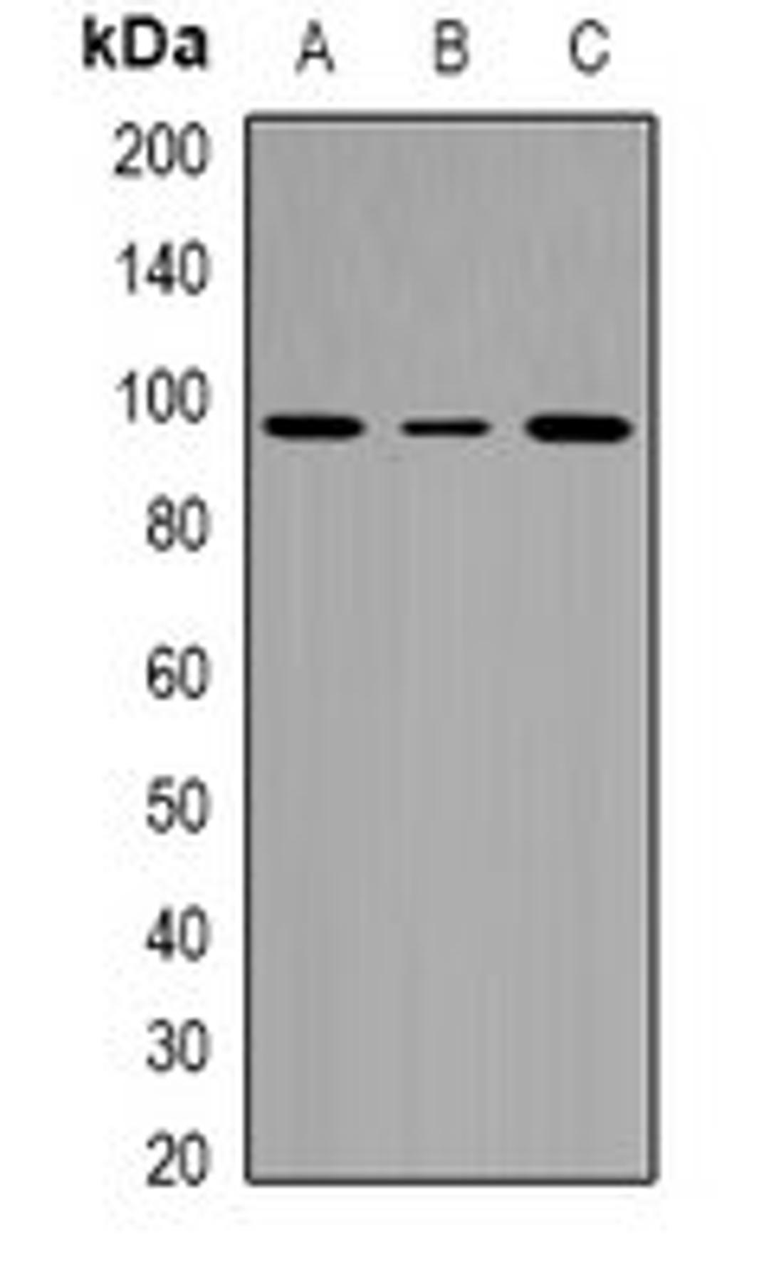 Western blot analysis of HepG2 (Lane1), Hela (Lane2), Jurkat (Lane3) whole cell lysates using CACTIN antibody