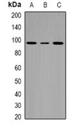 Western blot analysis of HepG2 (Lane1), Hela (Lane2), Jurkat (Lane3) whole cell lysates using CACTIN antibody