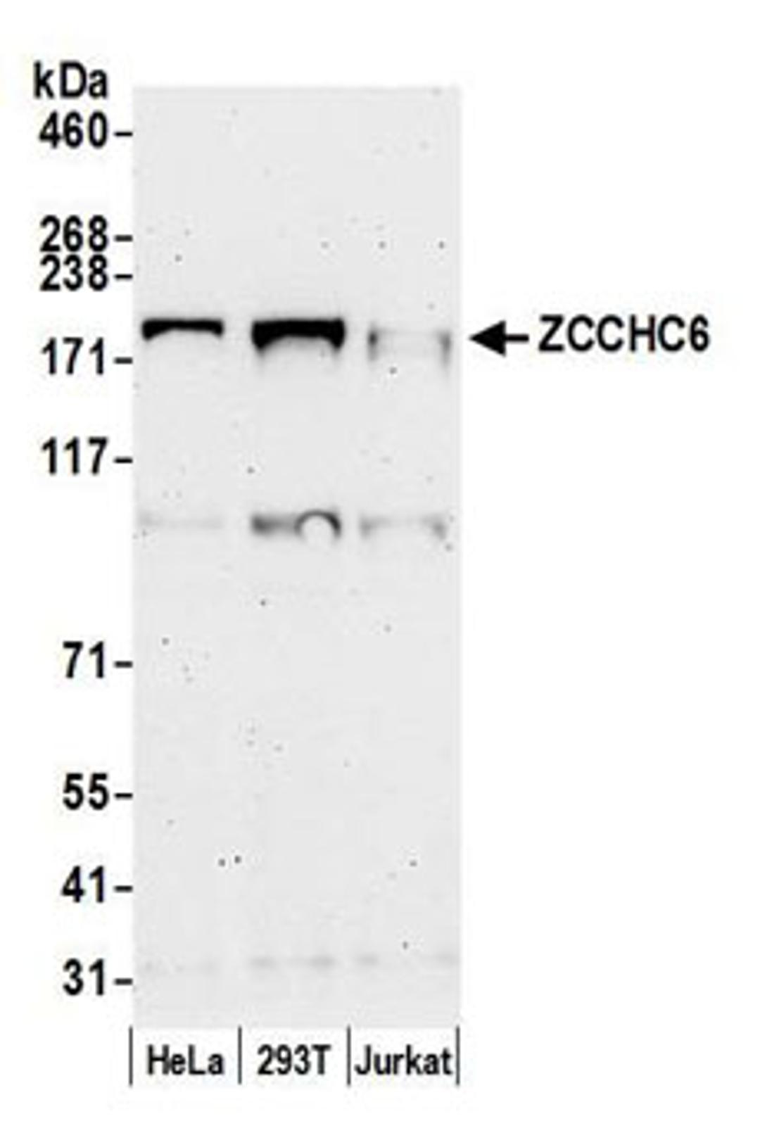 Detection of human ZCCHC6 by western blot.