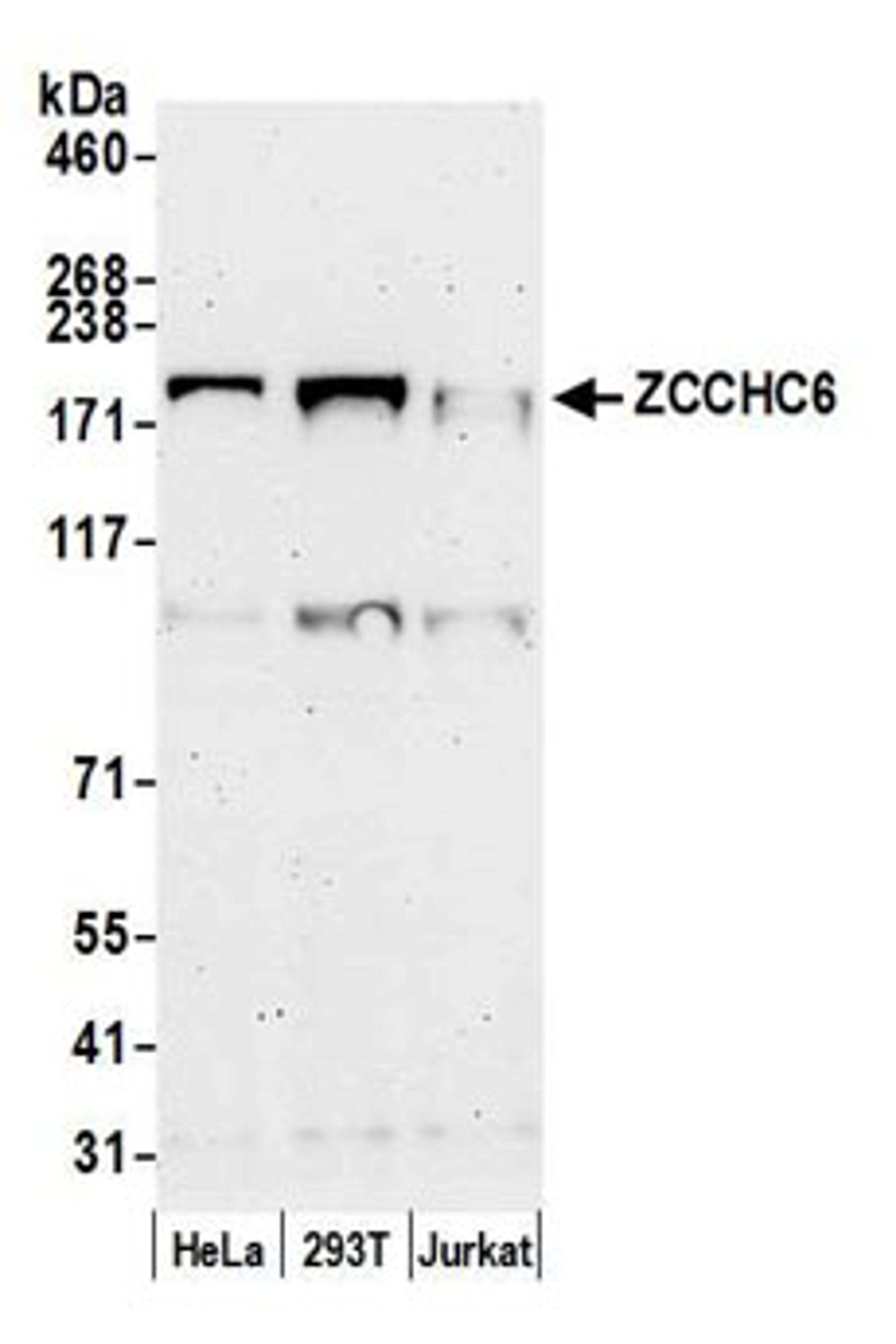 Detection of human ZCCHC6 by western blot.