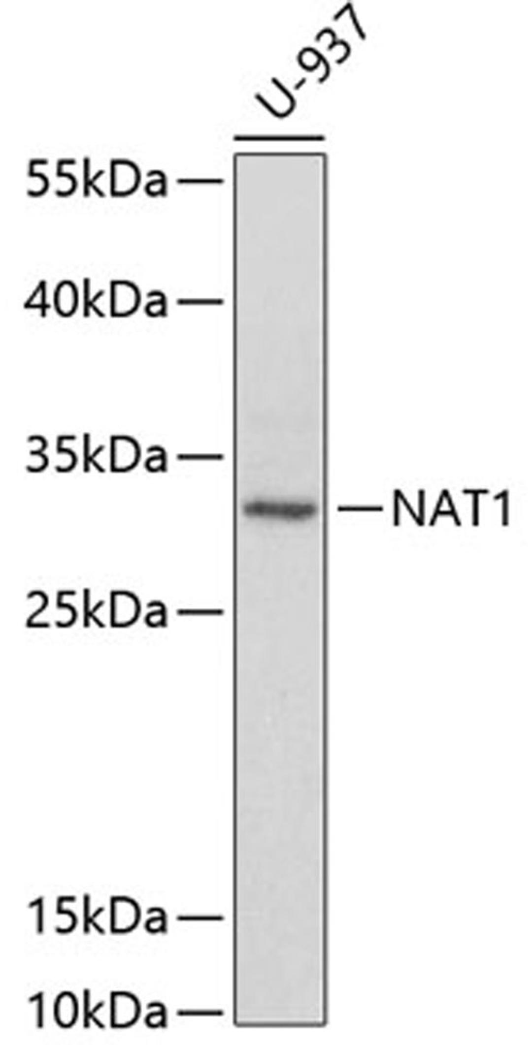 Western blot - NAT1 antibody (A1563)