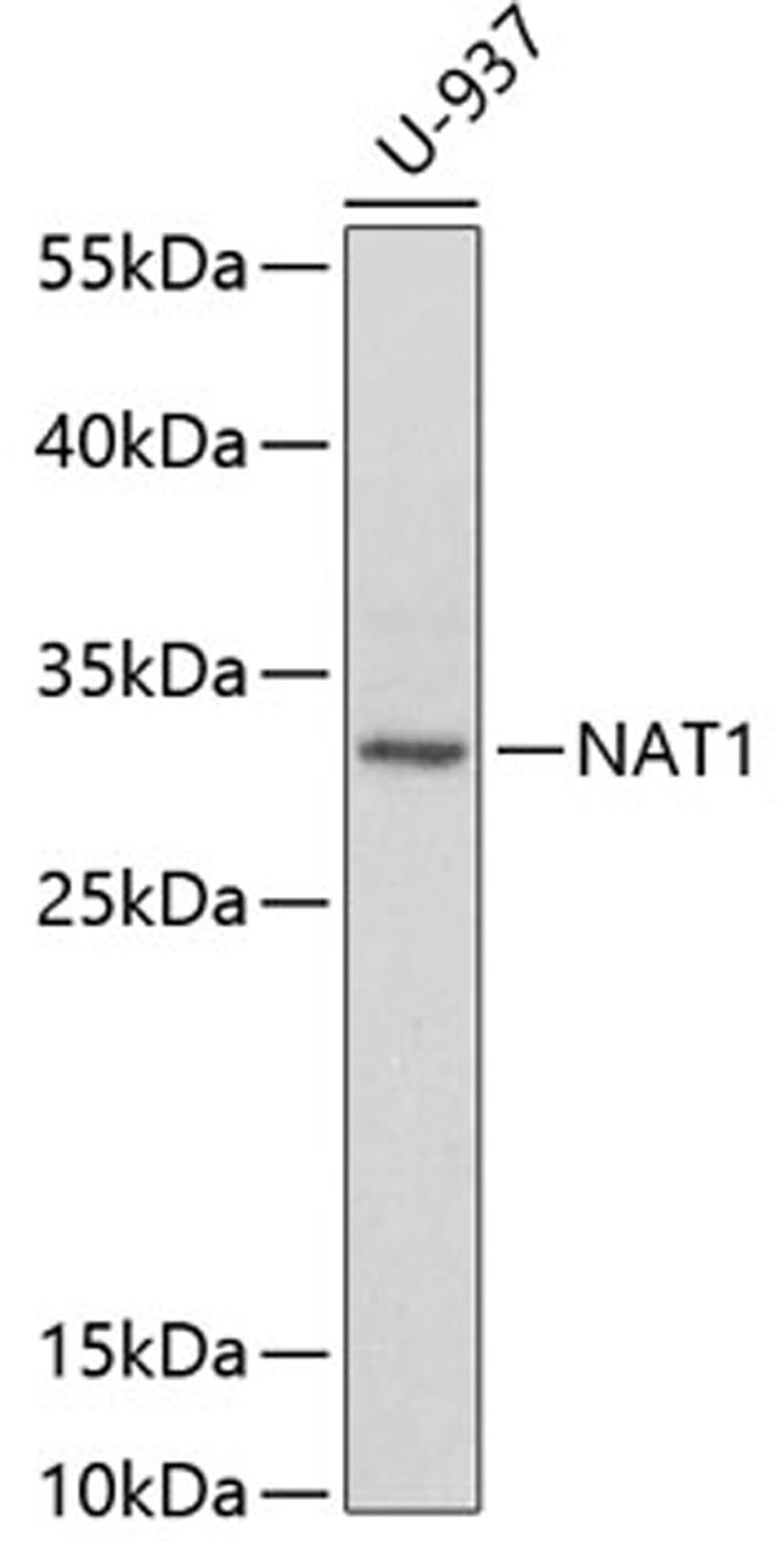 Western blot - NAT1 antibody (A1563)