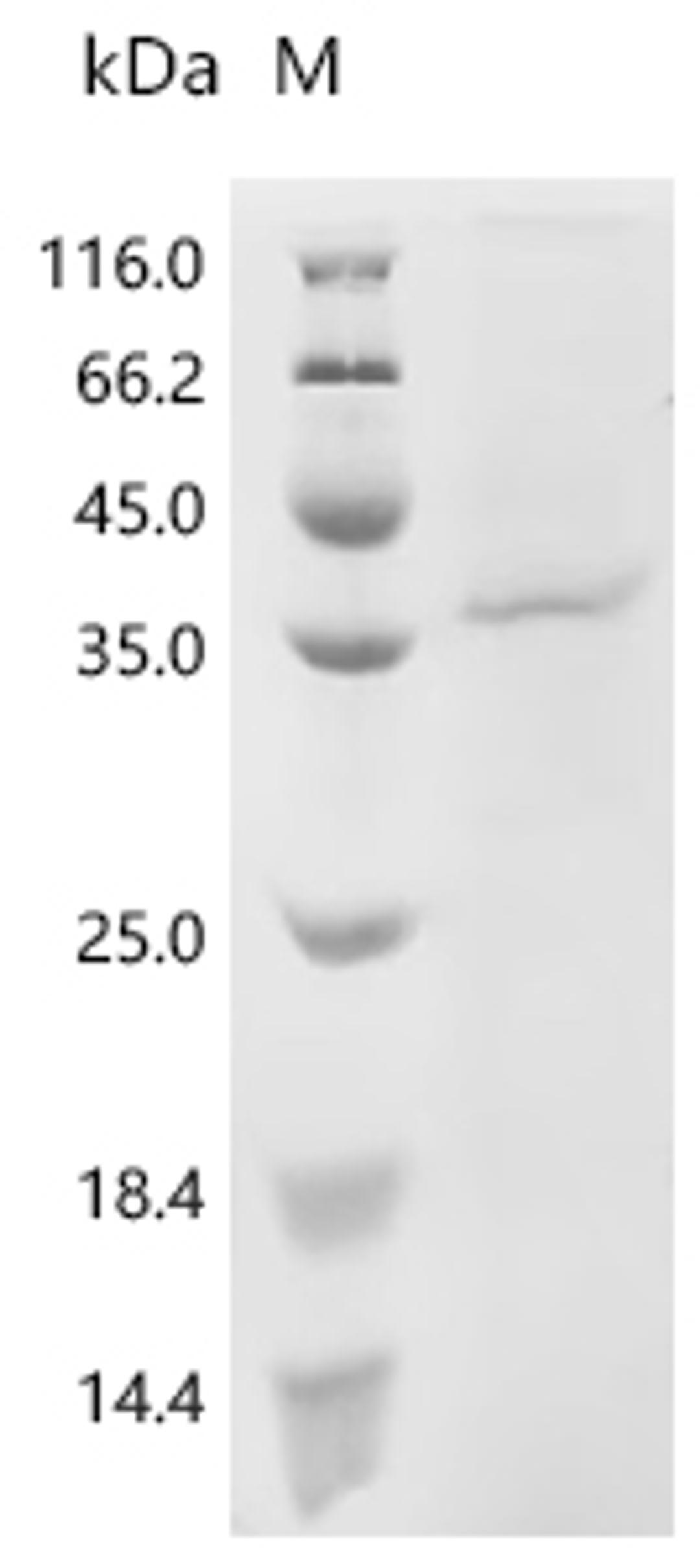 (Tris-Glycine gel) Discontinuous SDS-PAGE (reduced) with 5% enrichment gel and 15% separation gel.