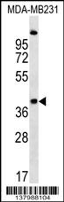 Western blot analysis in MDA-MB231 cell line lysates (35ug/lane).