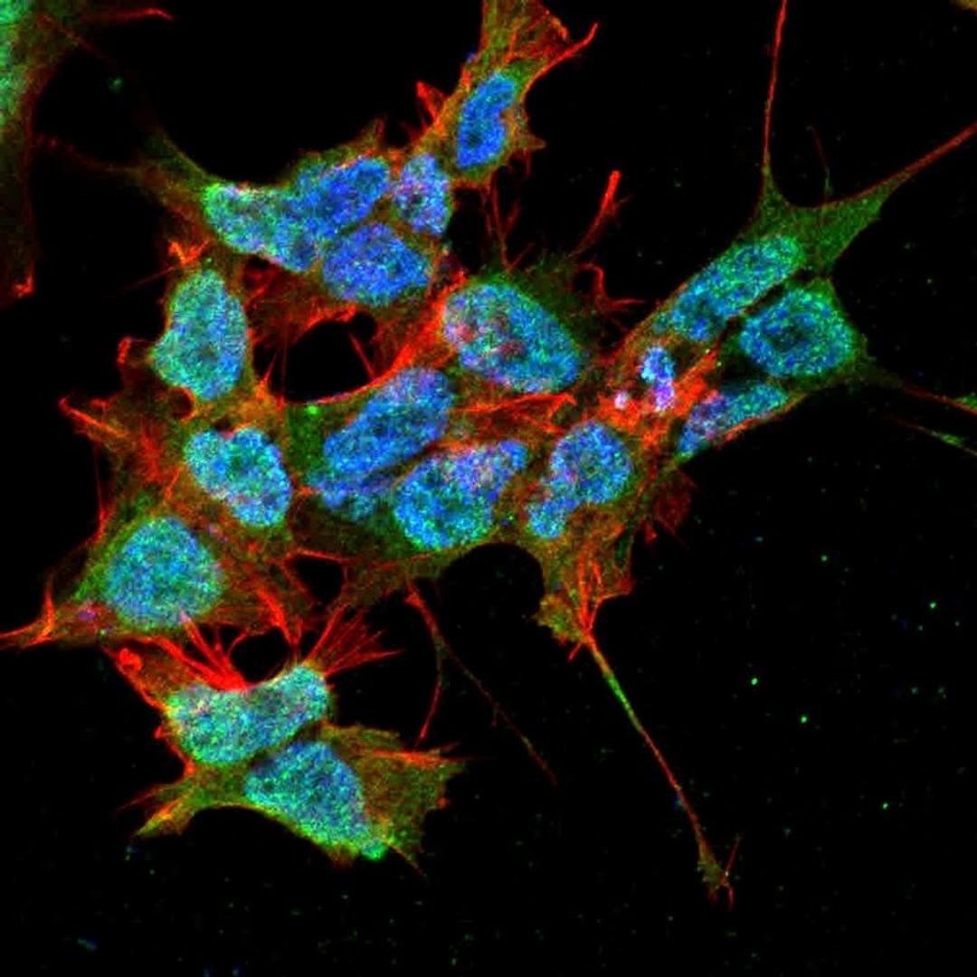 Immunofluorescence analysis of neuroblastoma cell line sk-n-be using PEX6 antibody