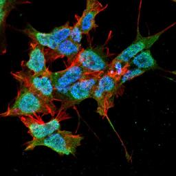 Immunofluorescence analysis of neuroblastoma cell line sk-n-be using PEX6 antibody