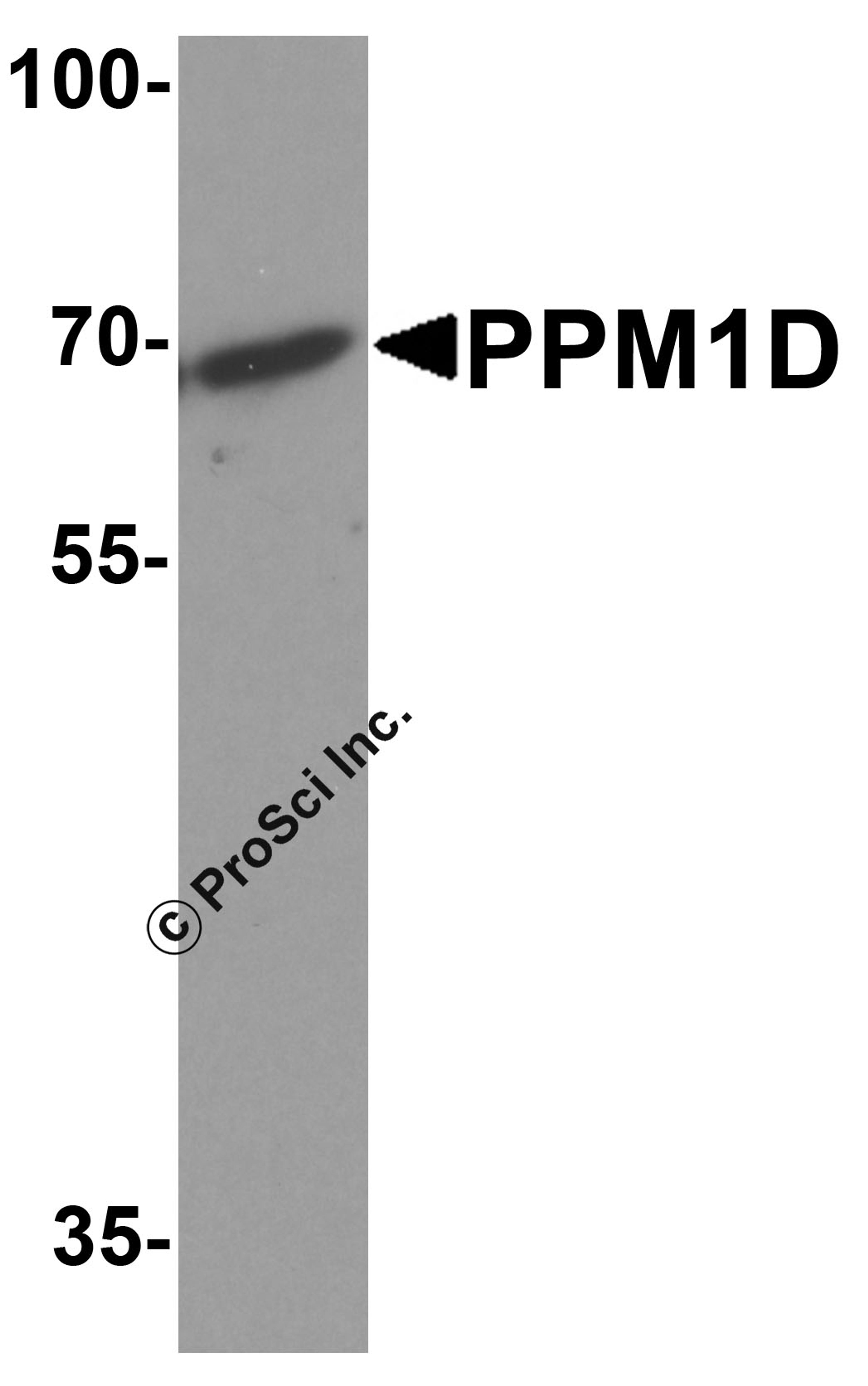 Western blot analysis of PPM1D in 3T3 cell lysate with PPM1D antibody at 1 μg/ml.