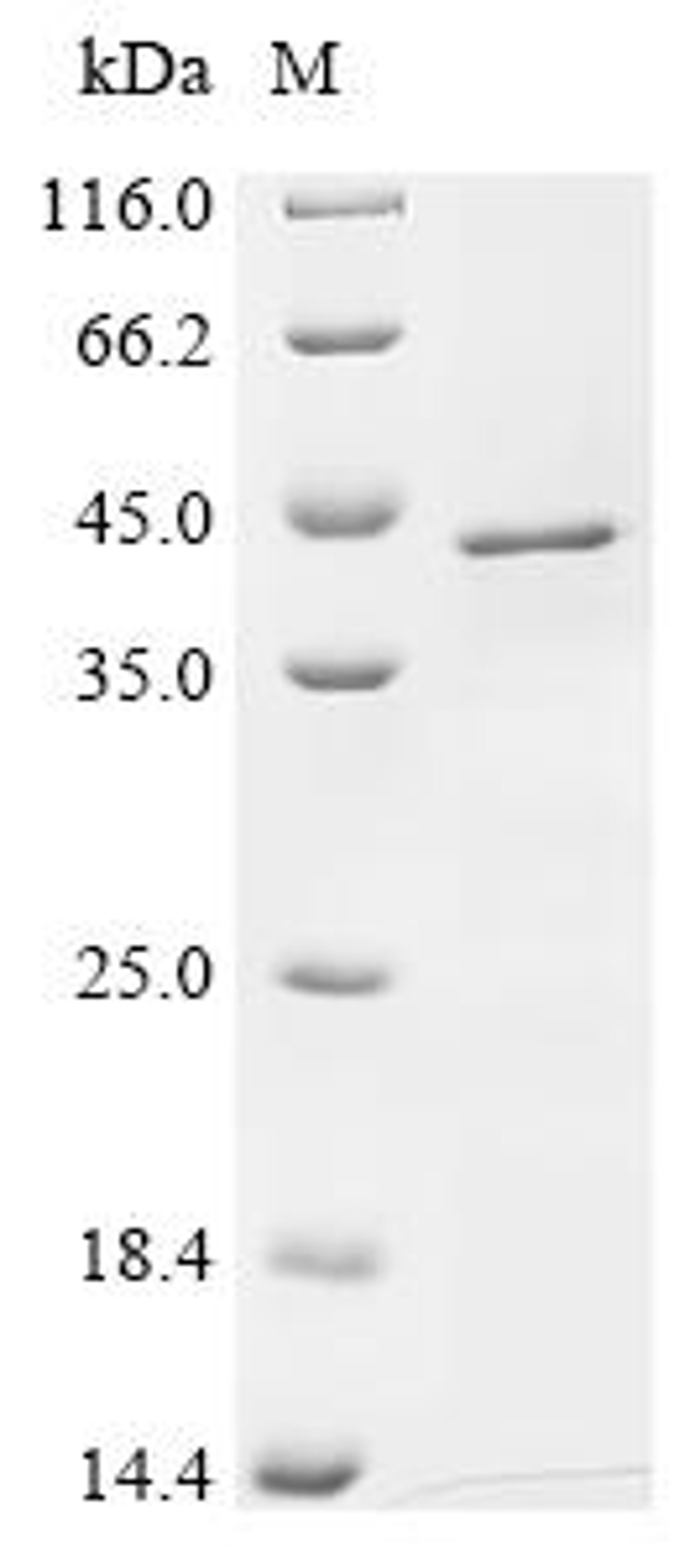 (Tris-Glycine gel) Discontinuous SDS-PAGE (reduced) with 5% enrichment gel and 15% separation gel.