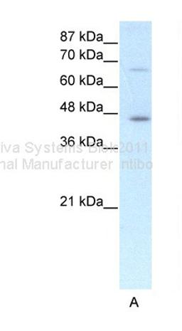 Antibody used in WB on Human HepG2 at 1.25 ug/ml.