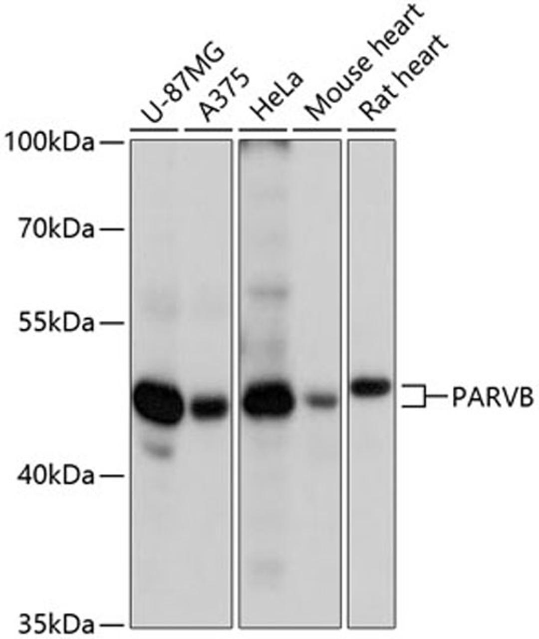 Western blot - PARVB antibody (A13161)