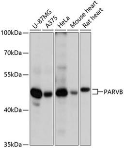 Western blot - PARVB antibody (A13161)