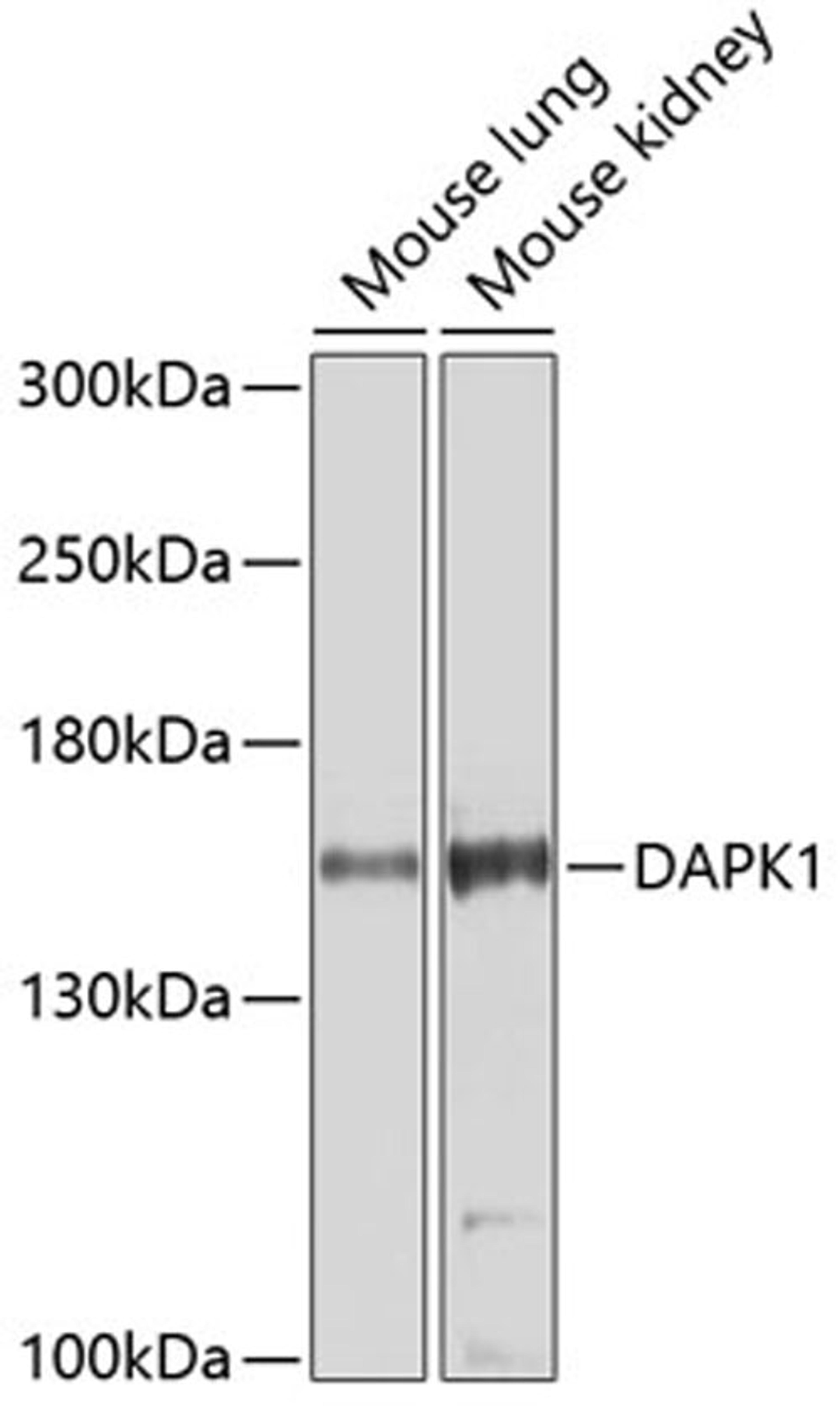 Western blot - DAPK1 Antibody (A5741)