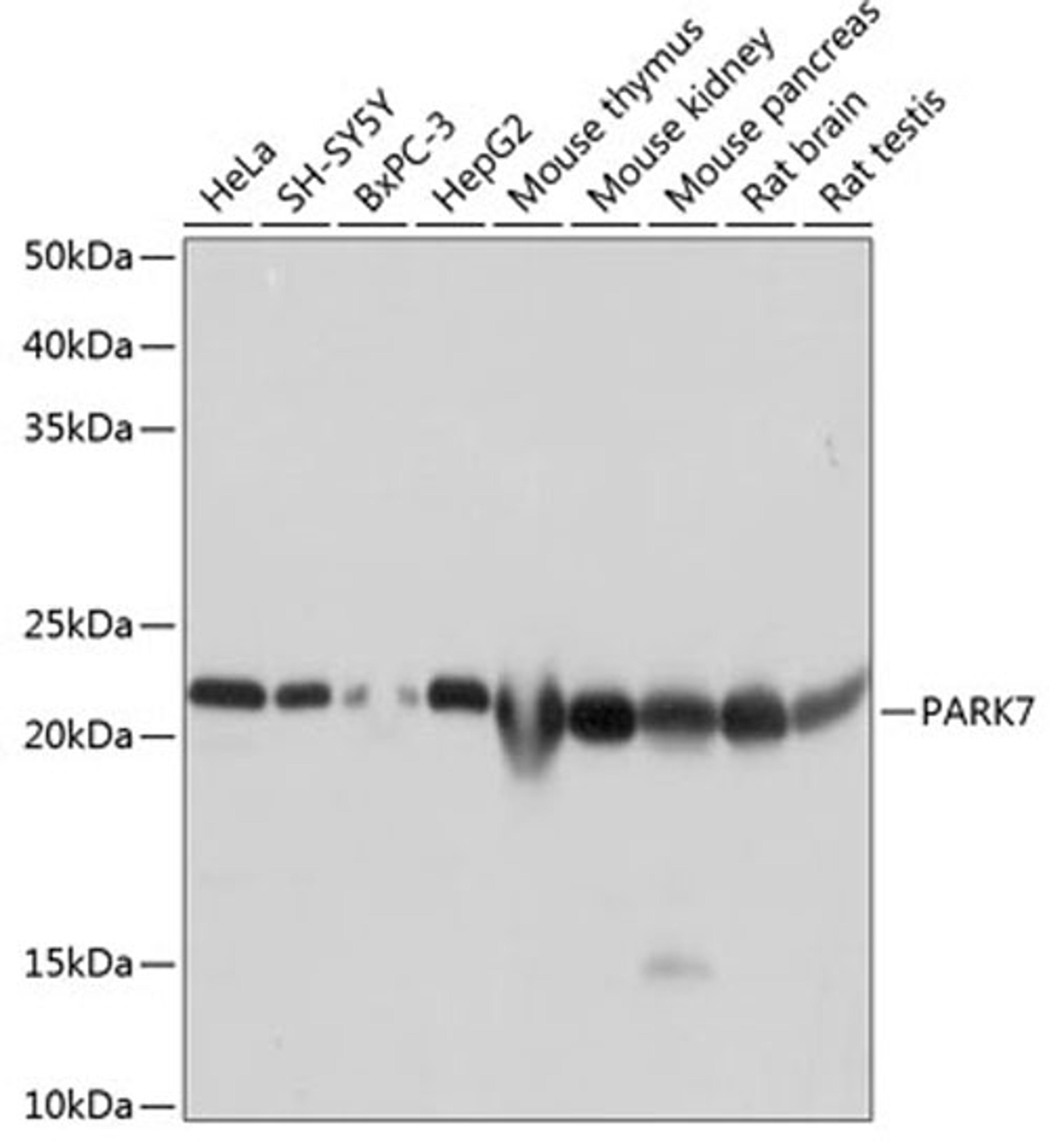 Western blot - PARK7 antibody (A19097)