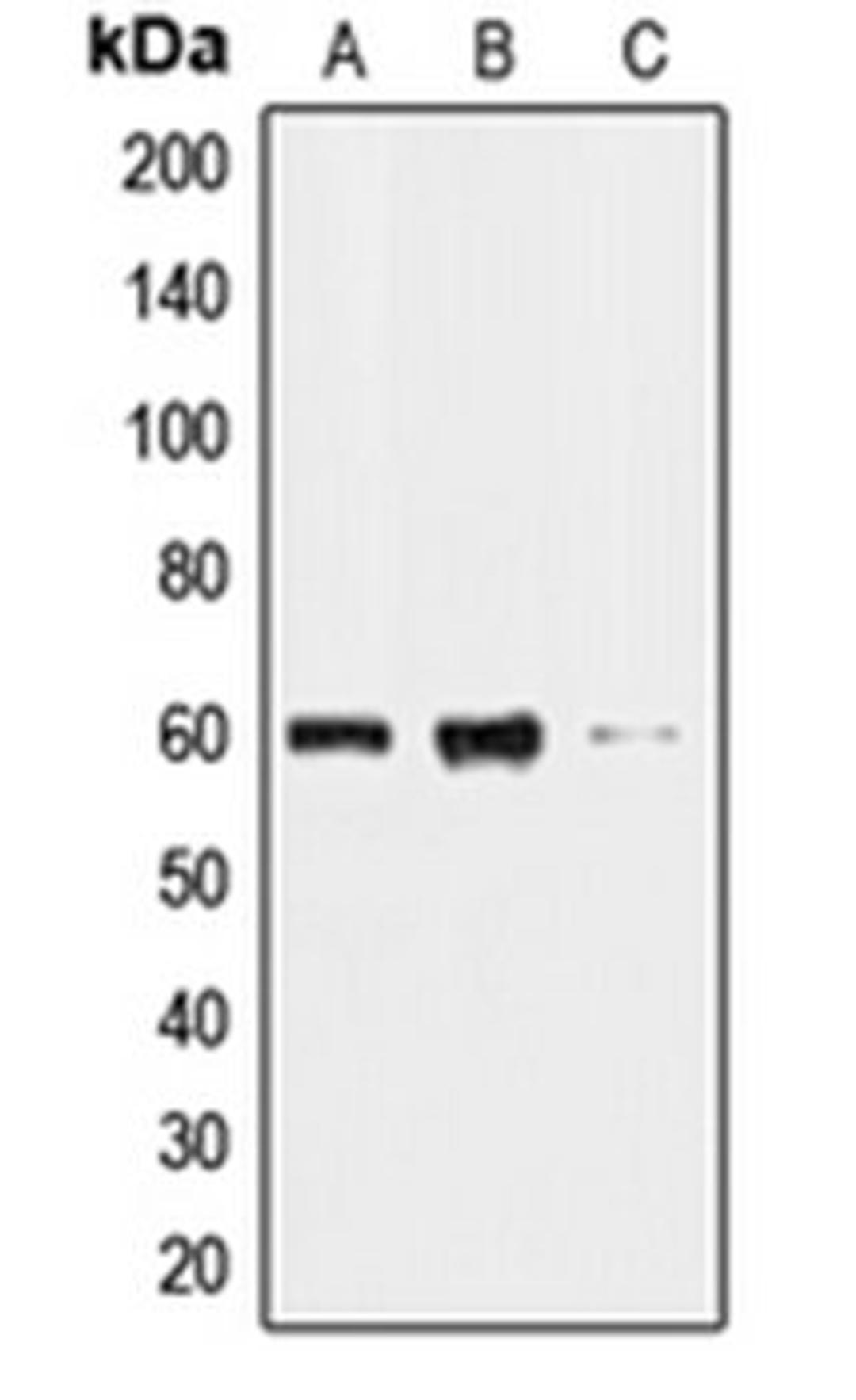 Western blot analysis of HL60 (Lane 1), HeLa (Lane 2), HepG2 (Lane 3) whole cell lysates using CLK2 antibody