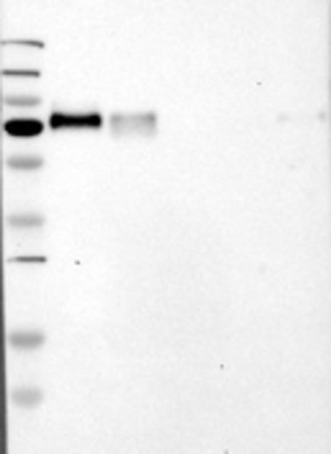 Western Blot: Granulin Antibody [26320002] -  Samples: Lane 1: Marker [kDa]: 250, 130, 95, 72, 55, 36, 28, 17, 11 / Lane 2: RT-4 / Lane 3: U-251MG sp / Lane 4: Human Plasma / Lane 5: Liver / Lane 6: Tonsil; Target weight [kDa]:  64, 47, 44 (splice variants)