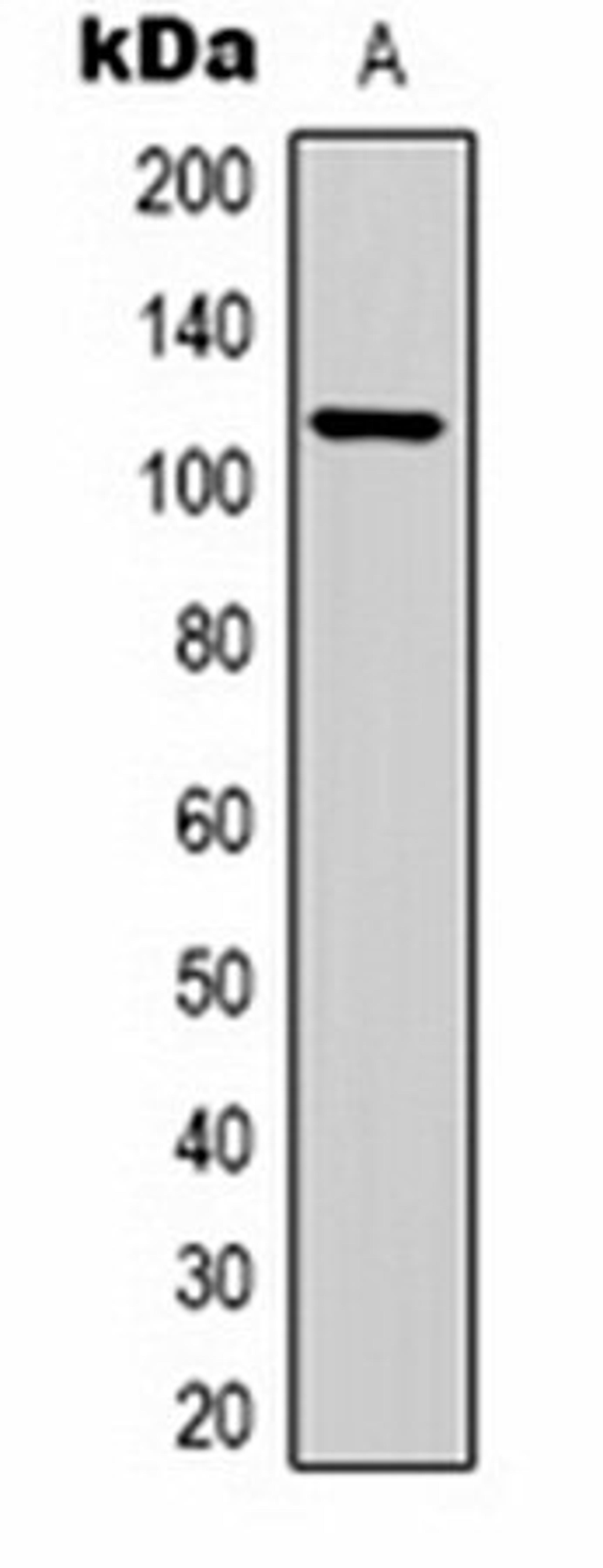 Western blot analysis of  pig skeletal muscle (Lane1) whole cell lysates using IGFN1 antibody