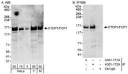 Detection of human and mouse CTDP1/FCP1 by western blot (h&m) and immunoprecipitation (h).