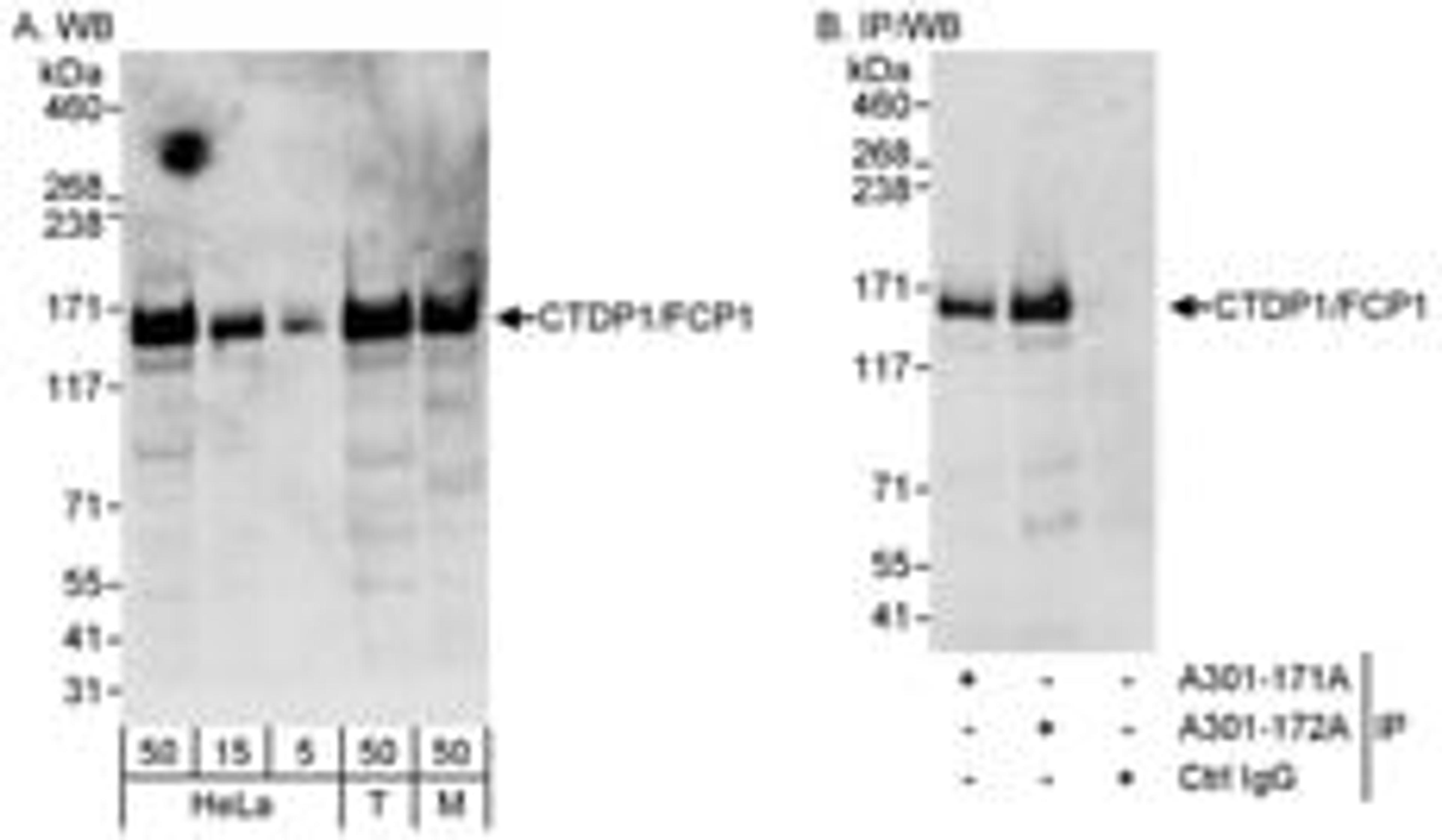 Detection of human and mouse CTDP1/FCP1 by western blot (h&m) and immunoprecipitation (h).