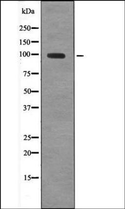 Western blot analysis of EGF treated HepG2 whole cell lysates using Androgen Receptor -Phospho-Ser81- antibody