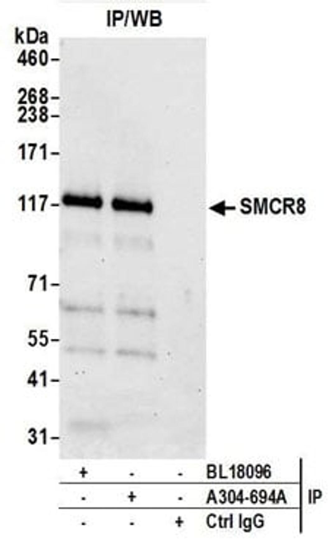 Detection of human SMCR8 by western blot of immunoprecipitates.