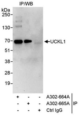 Detection of human UCKL1 by western blot of immunoprecipitates.