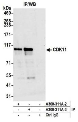 Detection of human CDK11 by western blot of immunoprecipitates.