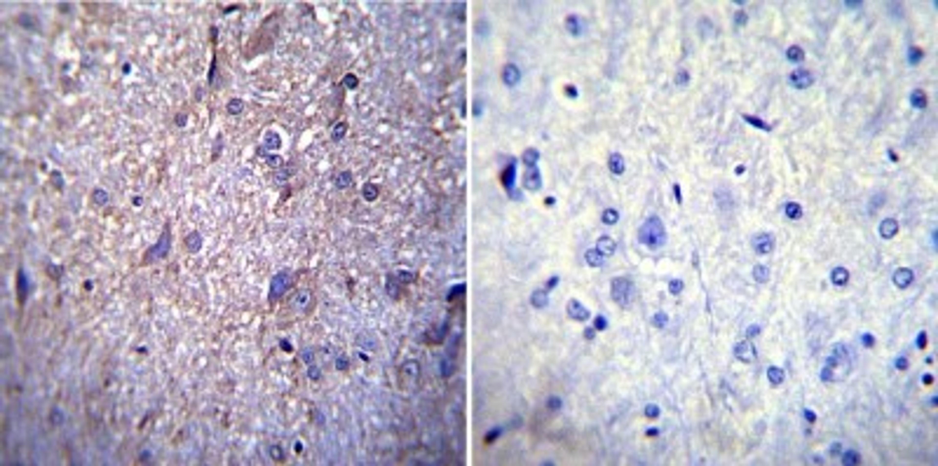 Immunohistochemistry-Paraffin: Nuclear Pore-O-Linked Glycoprotein Antibody (RL1) [NB600-1068] - Immunohistochemistry was performed on normal biopsies of deparaffinized Rat brain tissue. To expose target proteins, heat induced antigen retrieval was performed using 10mM sodium citrate (pH6.0)  buffer, microwaved for 8-15 minutes. Following antigen retrieval tissues were blocked in 3% BSA-PBS for 30 minutes at room temperature. Tissues were then probed at a dilution of 1:200 with a mouse monoclonal antibody recognizing Nuclear Pore-O-Linked Glycoprotein or without primary antibody (negative control) overnight at 4C in a humidified chamber. Tissues were washed extensively with PBST and endogenous peroxidase activity was quenched with a peroxidase suppressor.  Tissues were counterstained with hematoxylin and prepped for mounting.