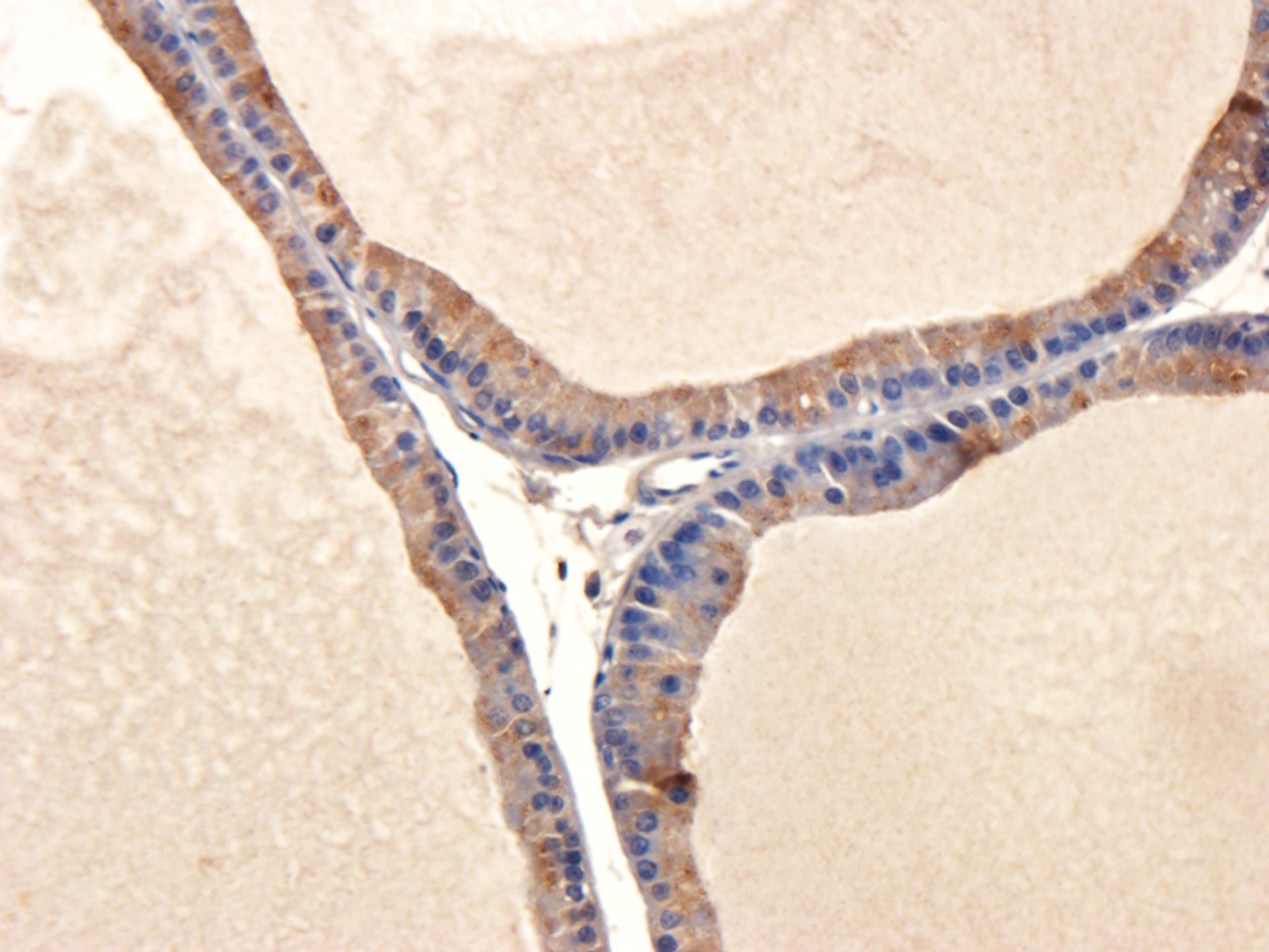 Immunohistochemical staining of paraffin embedded rat prostate tissue using anti-IL11 (5 ug/ml)